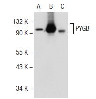 PYGB/M (10H5): sc-51922. Western blot analysis of PYGB expression in non-transfected 293T: sc-117752 (A), human PYGB transfected 293T: sc-170275 (B) and A-673 (C) whole cell lysates.