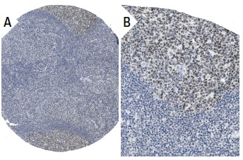 RAP1 (H-300): sc-28197. Immunoperoxidase staining of formalin fixed, paraffin-embedded human tonsil tissue showing nuclear staining of lymphoid cells (low and high magnification). Kindly provided by The Swedish Human Protein Atlas (HPA) program.