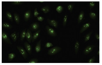 RRP9 (RS-9): sc-100592. Immunofluorescence staining of paraformaldehyde-fixed HeLa cells showing nuclear and nucleolar localization.