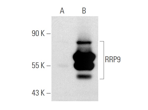 RRP9 (RS-9): sc-100592. Western blot analysis of RRP9 expression in non-transfected: sc-117752 (A) and human RRP9 transfected: sc-174103 (B) 293T whole cell lysates.
