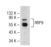 RRP9 (RS-9): sc-100592. Western blot analysis of RRP9 expression in Jurkat whole cell lysate.