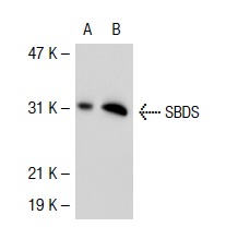 SBDS (S-15): sc-49257. Western blot analysis of SBDS expression in non-transfected: sc-117752 (A) and human SBDS transfected: sc-117277 (B) 293T whole cell lysates.