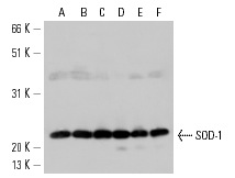 SOD-1 (C-17): sc-8637. Western blot analysis of SOD-1 expression in HeLa (A), Jurkat (B), Hep G2 (C), DU 145 (D), Hs68 (E) and CCD-1064Sk (F) whole cell lysates.