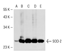 SOD-2 (B-1): sc-133254. Western blot analysis of SOD-2 expression in non-transfected 293T: sc-117752 (A), human SOD-2 transfected 293T: sc-113078 (B), HeLa (C), DU 145 (D) and T98G (E) whole cell lysates.