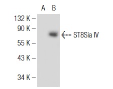 ST8Sia IV (H-70): sc-68896. Western blot analysis of ST8Sia IV expression in non-transfected: sc-117752 (A) and human ST8Sia IV transfected: sc-116438 (B) 293T whole cell lysates.