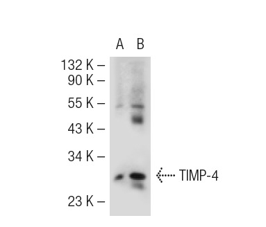 TIMP-4 (C-16): sc-9375. Western blot analysis of TIMP-4 expression in non-transfected: sc-117752 (A) and human TIMP-4 transfected: sc-112331 (B) 293T whole cell lysates.