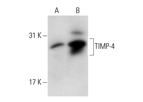 TIMP-4 (C-16): sc-9375. Western blot analysis of TIMP-4 expression in non-transfected: sc-117752 (A) and human TIMP-4 transfected: sc-176198 (B) 293T whole cell lysates.