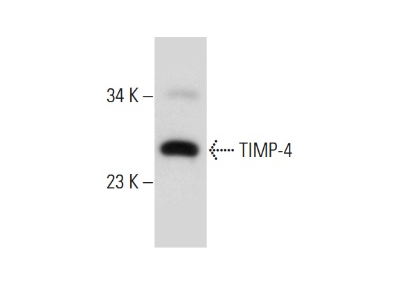 TIMP-4 (C-16): sc-9375. Western blot analysis of TIMP-4 expression in Sol8 whole cell lysate.