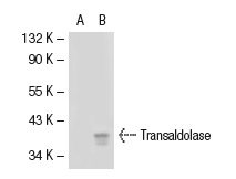 Transaldolase (S-17): sc-51439. Western blot analysis of Transaldolase expression in non-transfected: sc-117752 (A) and mouse Transaldolase transfected: sc-127699 (B) 293T whole cell lysates.