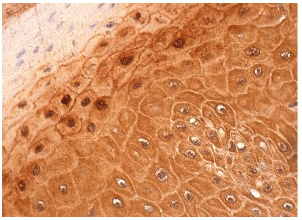 Transaldolase (S-17): sc-51439. Immunoperoxidase staining of formalin fixed, paraffin-embedded human oral mucosa tissue showing nuclear and cytoplasmic staining of squamous epithelial cells.