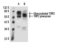 TRP2 (C-9): sc-74439. Western blot analysis of TRP2 expression in A-375 (A) and Y79 (B) whole cell lysates.