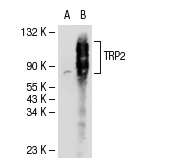 TRP2 (C-9): sc-74439. Western blot analysis of TRP2 expression in non-transfected: sc-117752 (A) and human TRP2 transfected: sc-113802 (B) 293T whole cell lysates.