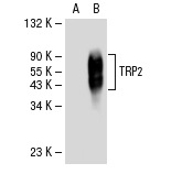 TRP2 (D-18): sc-10451. Western blot analysis of TRP2 expression in non-transfected: sc-117752 (A) and human TRP2 transfected: sc-113802 (B) 293T whole cell lysates.