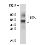 TRP2 (D-18): sc-10451. Western blot analysis of TRP2 expression in SK-MEL-28 whole cell lysate.