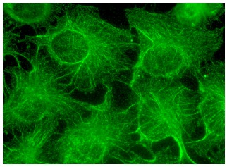 TRP2 (D-18): sc-10451. Immunofluorescence staining of methanol-fixed HeLa cells showing membrane localization.