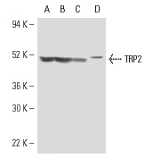 TRP2 (H-150): sc-25544. Western blot analysis of TRP2 expression in A-375 (A), Y79 (B), CTLL-2 (C) and WEHI-231 (D) whole cell lysates.