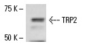 TRP2 (H-150): sc-25544. Western blot analysis of TRP2 expression in SK-MEL-28 whole cell lysate.