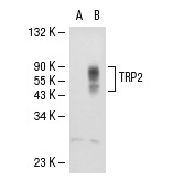TRP2 (H-150): sc-25544. Western blot analysis of TRP2 expression in non-transfected: sc-117752 (A) and human TRP2 transfected: sc-113802 (B) 293T whole cell lysates.