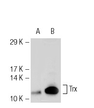 Trx (FL-105): sc-20146. Western blot analysis of Trx expression in 293T (A) and BJAB (B) whole cell lysates.