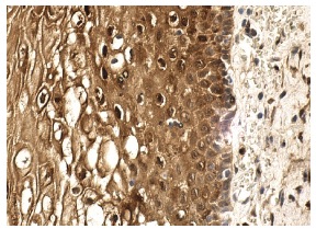 Trx (FL-105): sc-20146. Immunoperoxidase staining of formalin fixed, paraffin-embedded human cervix tissue showing cytoplasmic and nuclear staining of squamous epithelial cells.