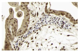 Ub (FL-76): sc-9133. Immunoperoxidase staining of formalin fixed, paraffin-embedded human placenta tissue showing nuclear staining in decidual cells and cytoplasmic and nuclear stainining in trophoblastic cells. Kindly provided by The Swedish Human Protein Atlas (HPA) program.
