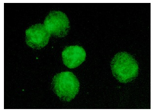 UBC9 (N-15): sc-5231. Immunofluorescence staining of methanol-fixed Jurkat cells showing nuclear staining.