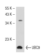 UBC9 (N-15): sc-5231. Western blot analysis of UBC9 expression in HeLa whole cell lysate.