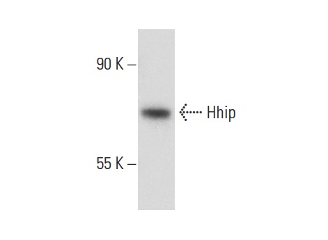 Hhip (R-20): sc-9408. Western blot analysis of Hhip expression in COLO 320DM whole cell lysate.