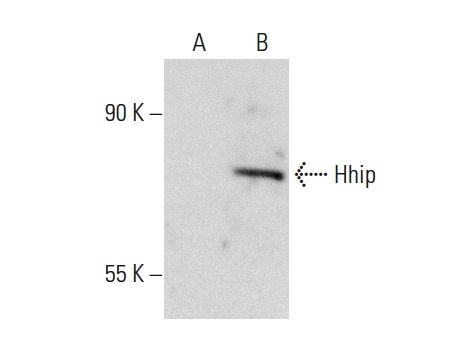 Hhip (R-20): sc-9408. Western blot analysis of Hhip expression in non-transfected: sc-117752 (A) and human Hhip transfected: sc-170166 (B) 293T whole cell lysates.