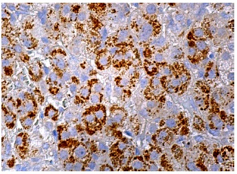 UBE2C (B-12): sc-166339. Immunoperoxidase staining of formalin fixed, paraffin-embedded human adrenal gland tissue showing cytoplasmic staining of glandular cells.