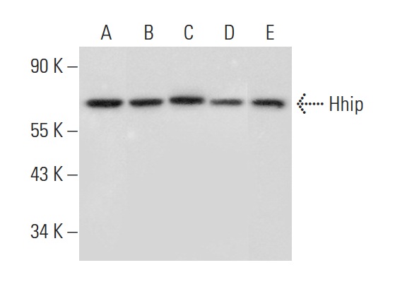Hhip (R-20): sc-9408. Western blot analysis of Hhip expression in HeLa (A), NTERA-2 cl.D1 (B), MCF7 (C), HEK293 (D) and A549 (E) whole cell lysates.
