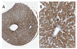 UGT2B (H-300): sc-50386. Immunoperoxidase staining of formalin fixed, paraffin-embedded human liver tissue showing cytoplasmic staining of hepatocytes in low (A) and high (B) resolution. Kindly provided by The Swedish Human Protein Atlas (HPA) program.