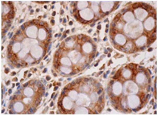 UGT2B (H-300): sc-50386. Immunoperoxidase staining of formalin fixed, paraffin-embedded human colon tissue showing cytoplasmic staining of glandular cells.