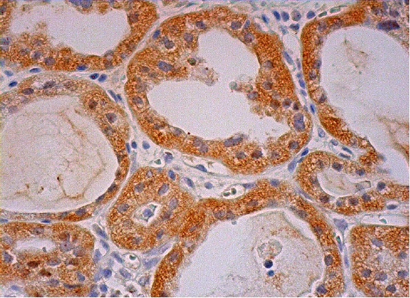 HM74 (D-8): sc-377292. Immunoperoxidase staining of formalin fixed, paraffin-embedded human thyroid gland tissue showing cytoplasmic staining of glandular cells.
