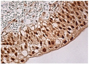 USP4 (H-3): sc-376000. Immunoperoxidase staining of formalin fixed, paraffin-embedded human kidney tissue showing nuclear and cytoplasmic staining of urothelial cells.