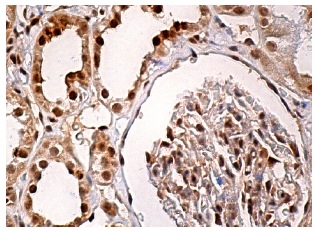 USP4 (H-3): sc-376000. Immunoperoxidase staining of formalin fixed, paraffin-embedded human kidney tissue showing nuclear and cytoplasmic staining of cells in glomeruli and tubules.