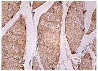 USP4 (H-3): sc-376000. Immunoperoxidase staining of formalin fixed, paraffin-embedded human skeletal muscle tissue showing nuclear and cytoplasmic staining of myocytes.