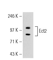 Ect2 (C-20): sc-1005. Western blot analysis of Ect2 expression in HeLa whole cell lysates.