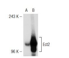 Ect2 (C-20): sc-1005. Western blot analysis of Ect2 expression in non-transfected: sc-117752 (A) and mouse Ect2 transfected: sc-119913 (B) 293T whole cell lysates.