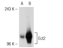 Ect2 (C-20): sc-1005. Western blot analysis of Ect2 expression in non-transfected: sc-117752 (A) and mouse Ect2 transfected: sc-119914 (B) 293T whole cell lysates.