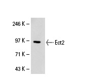Ect2 (H-300): sc-25637. Western blot analysis of Ect2 expression in non-transfected: sc-110760 (A) and human Ect2 transfected: sc-110479 (B) 293 whole cell lysates.