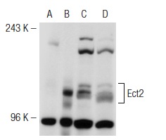 Ect2 (H-300): sc-25637. Western blot analysis of Ect2 expression in non-transfected 293T: sc-117752 (A), mouse Ect2 transfected 293T: sc-119913 (B), NIH/3T3 (C) and 3T3-L1 (D) whole cell lysates.