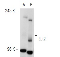 Ect2 (H-300): sc-25637. Western blot analysis of Ect2 expression in non-transfected: sc-117752 (A), mouse Ect2 transfected: sc-119914 (B) 293T whole cell lysates.