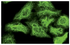 G<sub>α s/olf</sub> (A-5): sc-55545. Immuno?fluorescence staining of methanol-fixed HeLa cells showing cytoplasmic and membrane local?ization.