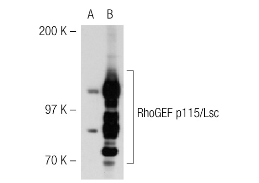 RhoGEF p115 of human origin and Lsc of mouse and rat origin (H-165): sc-20804. Western blot analysis of RhoGEF p115 expression in non-transfected: sc-117752 (A) and human RhoGEF p115 transfected: sc-113634 (B) 293T whole cell lysates.