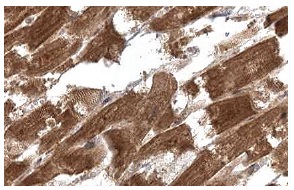 R-Ras (C-19): sc-523. Immunoperoxidase staining of formalin fixed, paraffin-embedded human heart muscle tissue showing cytoplasmic staining of myocytes at high magnification. Kindly provided by The Swedish Human Protein Atlas (HPA) program.
