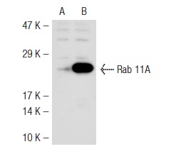 Rab 11 (H-87): sc-9020. Western blot analysis of Rab 11A expression in non-transfected: sc-117752 (A) and mouse Rab 11A transfected: sc-122877 (B) 293T whole cell lysates.