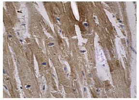 Rab 11 (H-87): sc-9020. Immunoperoxidase staining of formalin fixed, paraffin-embedded human heart muscle tissue showing cytoplasmic staining of myocytes.