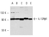 IL-12Rβ1 (C-20): sc-658. Western blot analysis of IL-12 receptor β1 expression in CCRF-HSB-2 (A), CCRF-CEM (B), BYDP (C), WEHI-231 (D) and WEHI-3 (E) whole cell lysates.
