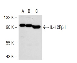 IL-12Rβ1 (C-20): sc-658. Western blot analysis of IL-12Rβ1 expression in non-transfected 293T: sc-117752 (A), mouse IL-12Rβ1 transfected 293T: sc-121031 (B) and BYDP (C) whole cell lysates.